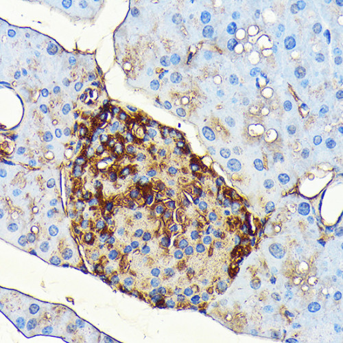 Glucagon Rabbit mAb