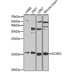 KCNE1 Rabbit pAb