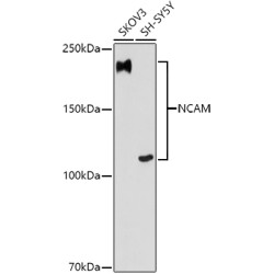 NCAM Rabbit mAb