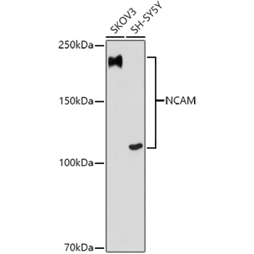 NCAM Rabbit mAb