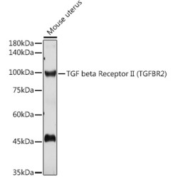 TGF beta Receptor II Rabbit pAb