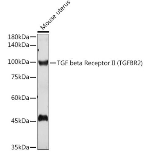 TGF beta Receptor II Rabbit pAb