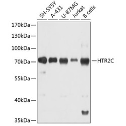 HTR2C Rabbit pAb