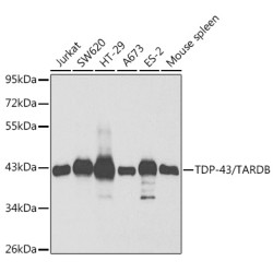 TDP-43/TARDBP Rabbit pAb