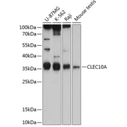 CD301/CLEC10A Rabbit pAb