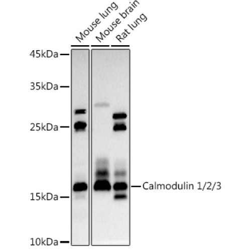 Calmodulin 1/2/3 Rabbit pAb