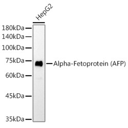 Alpha-Fetoprotein (AFP) Mouse mAb