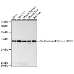 S6 Ribosomal Protein (RPS6) Rabbit mAb
