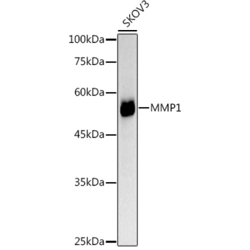MMP1 Rabbit pAb