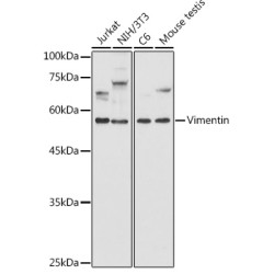 [KD Validated] Vimentin Rabbit pAb