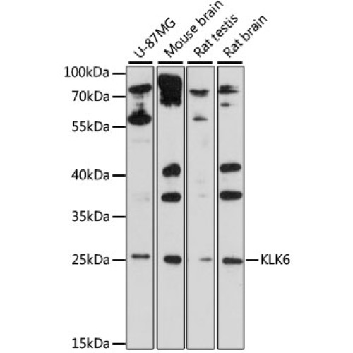 KLK6 Rabbit pAb