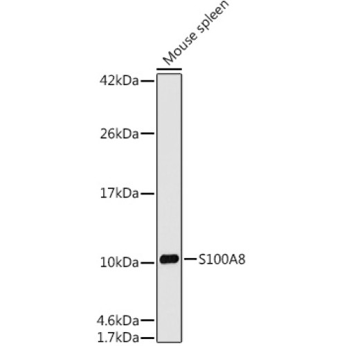 S100A8 Rabbit mAb