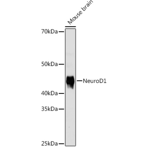 NeuroD1 Rabbit mAb