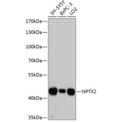 NPTX2 Rabbit pAb