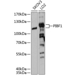 PIBF1 Rabbit pAb