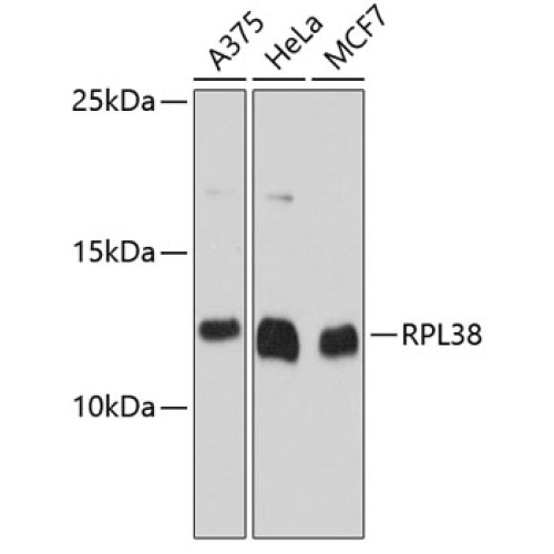 RPL38 Rabbit pAb