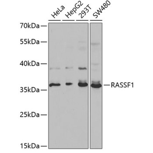 RASSF1 Rabbit pAb