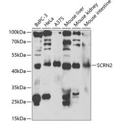SCRN2 Rabbit pAb