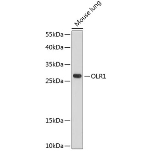 OLR1 Rabbit pAb
