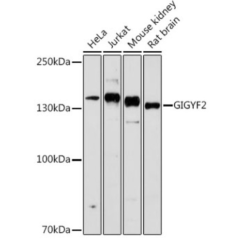 GIGYF2 Rabbit pAb