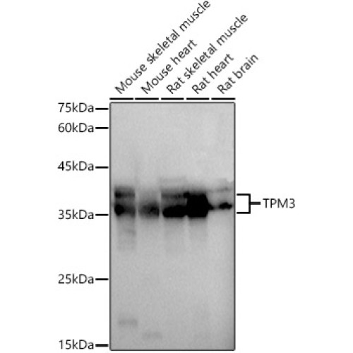 TPM3 Rabbit pAb