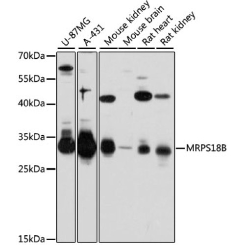 MRPS18B Rabbit pAb