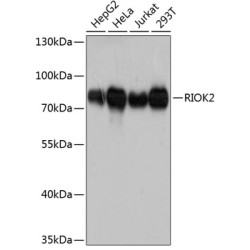 RIOK2 Rabbit pAb