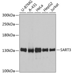 SART3 Rabbit pAb