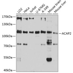 ACAP2 Rabbit pAb