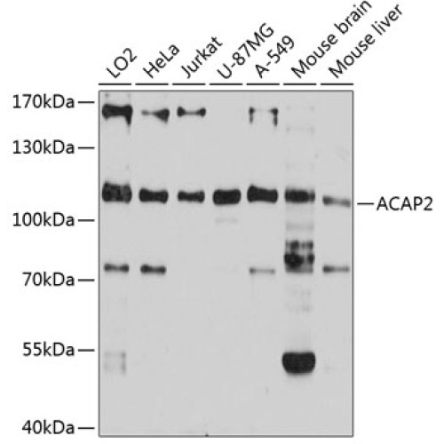 ACAP2 Rabbit pAb