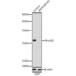 [KO Validated] RhoGDI Rabbit pAb