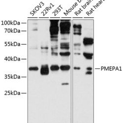 PMEPA1 Rabbit pAb