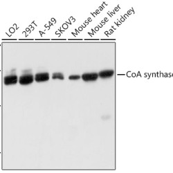 CoA synthase (COASY） Rabbit pAb