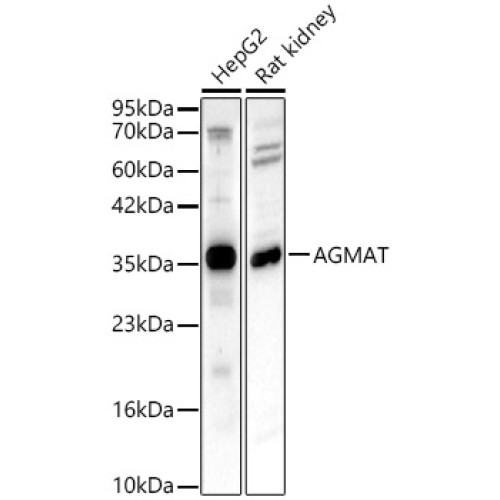 AGMAT Rabbit pAb