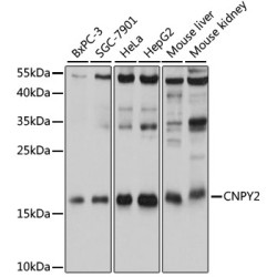 CNPY2 Rabbit pAb
