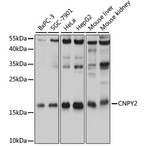 CNPY2 Rabbit pAb