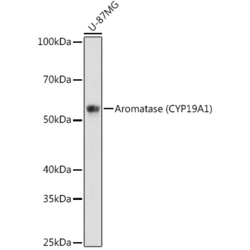 Aromatase (CYP19A1) Rabbit mAb