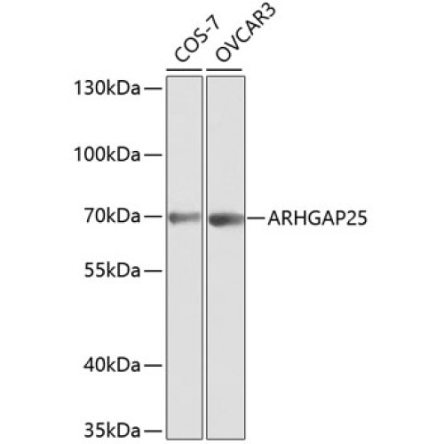 ARHGAP25 Rabbit pAb