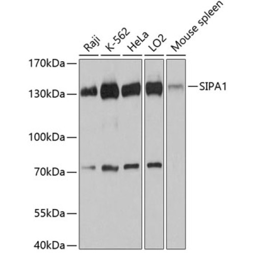 SIPA1 Rabbit pAb