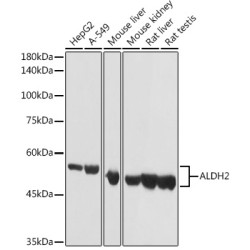 ALDH2 Rabbit pAb