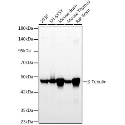 β-Tubulin Rabbit mAb