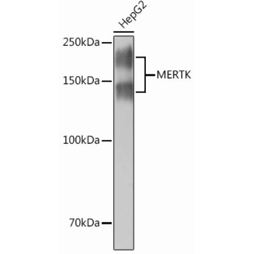 MERTK Rabbit mAb