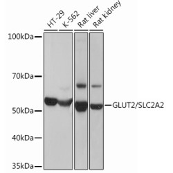 GLUT2/SLC2A2 Rabbit mAb