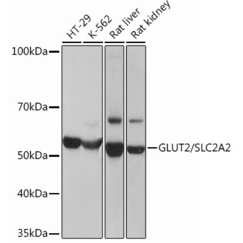 GLUT2/SLC2A2 Rabbit mAb