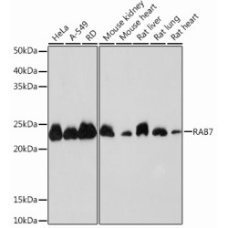RAB7 Rabbit mAb