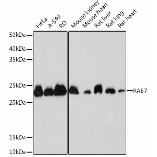 RAB7 Rabbit mAb