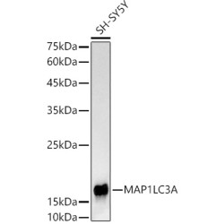 MAP1LC3A Rabbit mAb