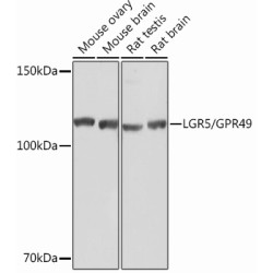 LGR5/GPR49 Rabbit mAb