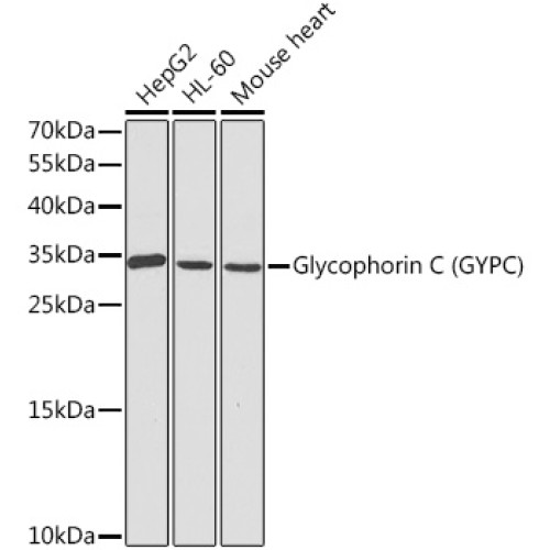 Glycophorin C (GYPC) Rabbit pAb