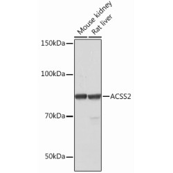 ACSS2 Rabbit mAb